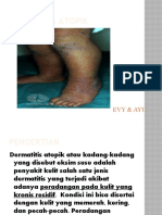 Dermatitis Atopik Evy & Ayu New