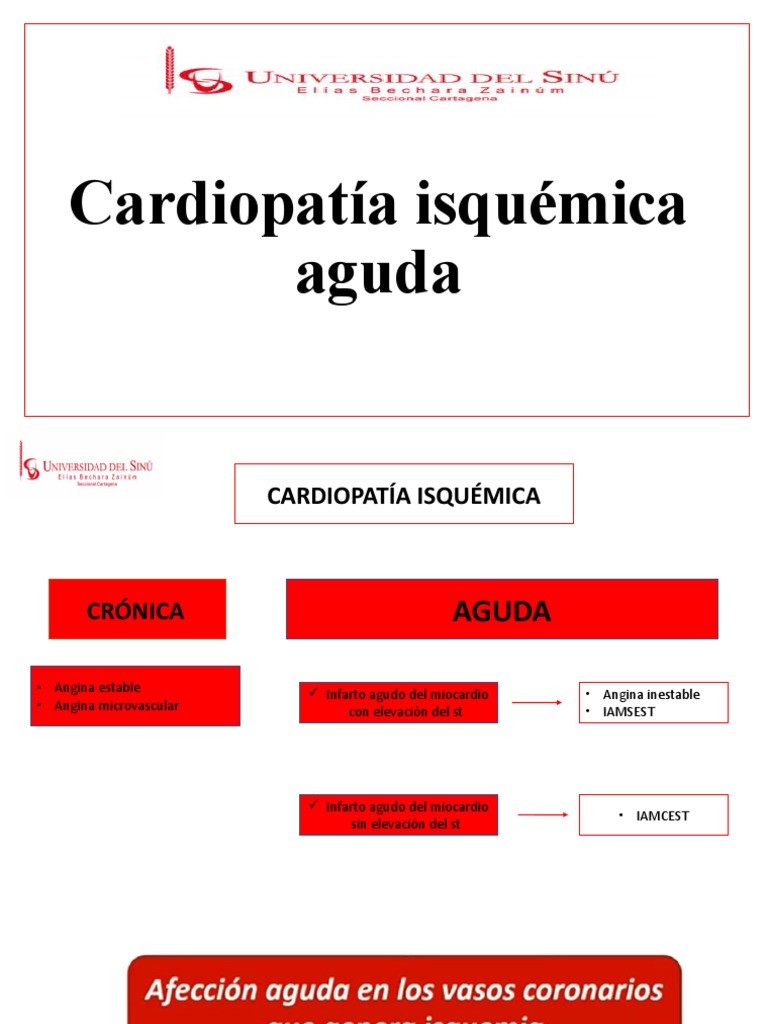 Cardiopatía Isquémica | PDF | Infarto de miocardio | Isquemia