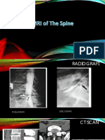 Mri of The Spine-2022