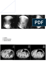 RADIOLOGI TEST