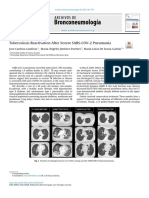 Tuberculosis Reactivation After Severe Sars-Cov-2 Pneumonia