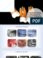 LP Odontectomie M3 Superiori