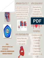 Lefleat Patent Duktus Arteriosis