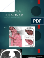 Enfisema Pulmonar