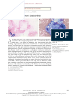 Cholesterol Pericarditis NEJM