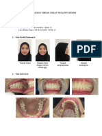 Indikasi Gigi Tiruan Cekat Negative Room