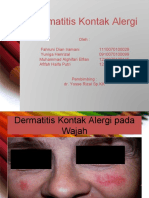 Dermatitis Kontak Alergi