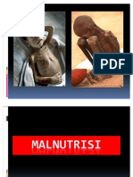 Malnutrisi