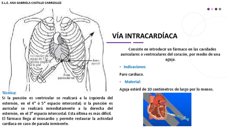 Inyección Intracardiaca en Emergencias | PDF