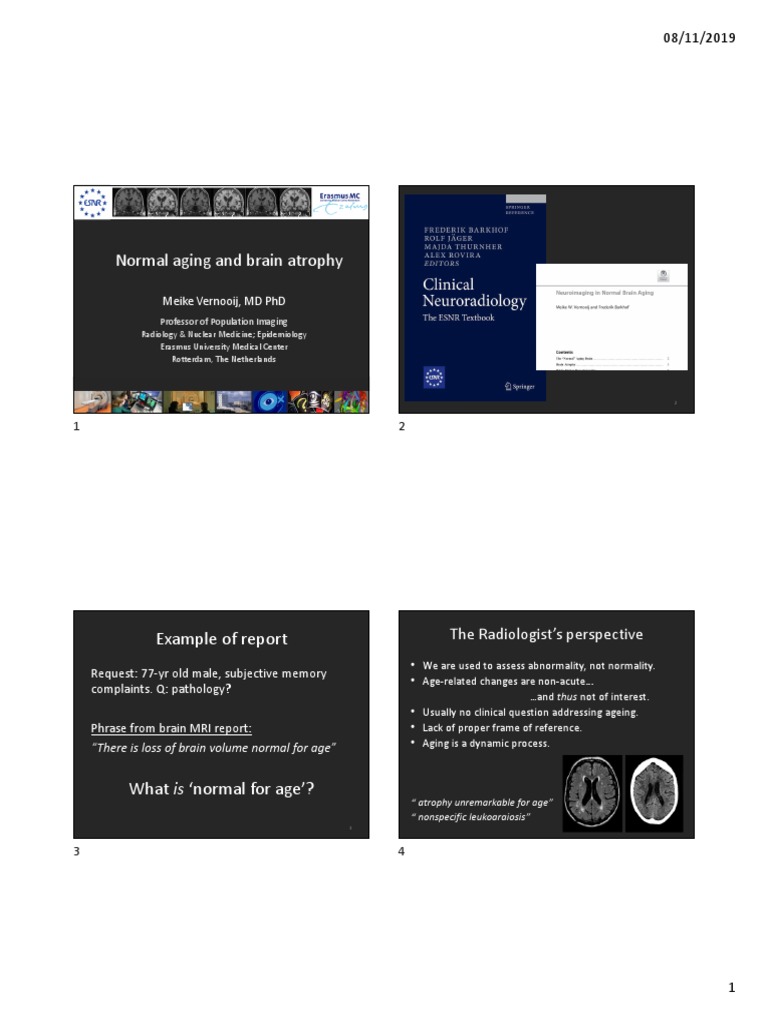 Normal Aging and Brain Atrophy Insights | PDF | Stroke | Hippocampus