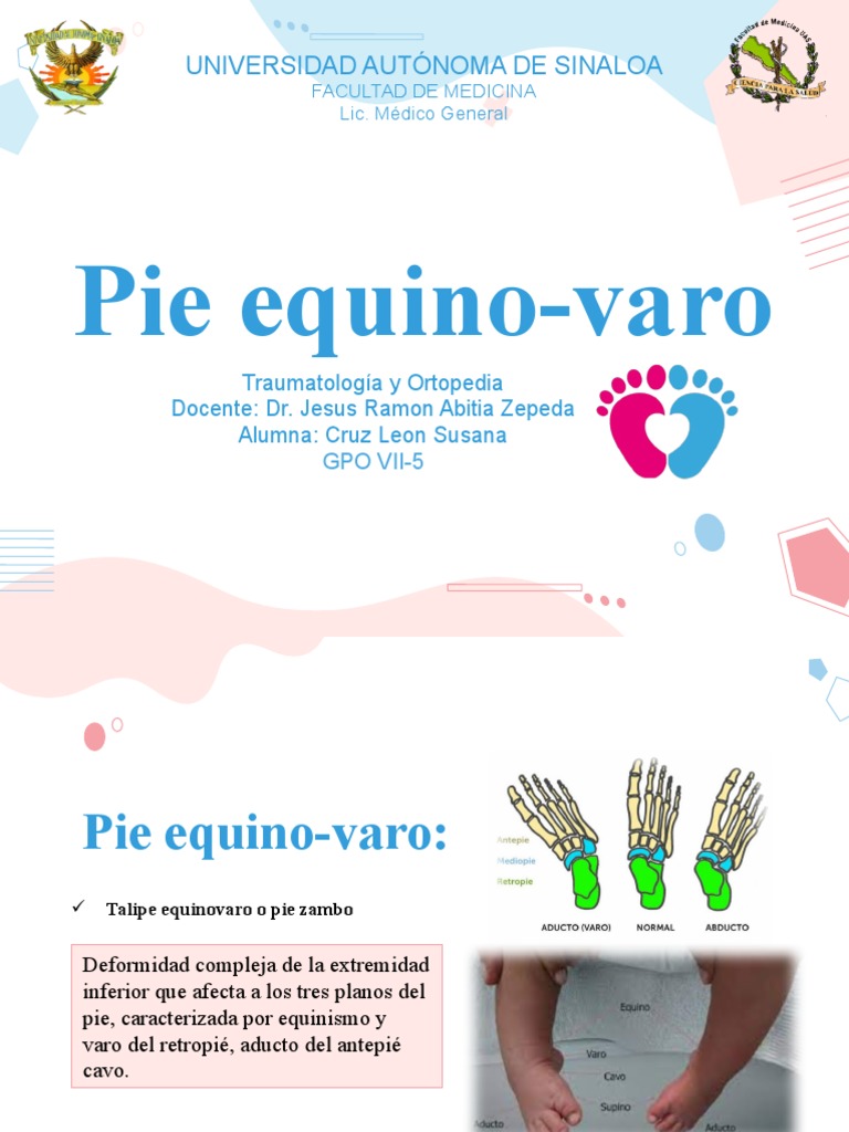 Pie Equinovaro Susy PDF Pie Anatomía humana