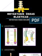 Metastasis Osea Blastica
