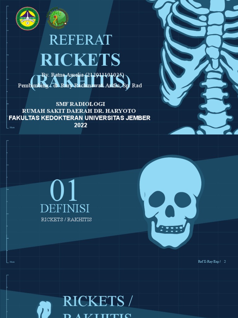 Rakhitis: Tinjauan oleh Ratna Amelia | PDF
