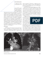 Diagnóstico de Tromboembolismo Pulmonar por Imagem