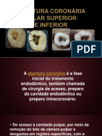 Abertura Coronária Molar Superior e Inferior