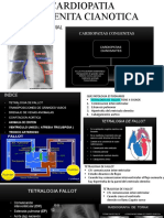 Cardiopatia Congenita Cianotica