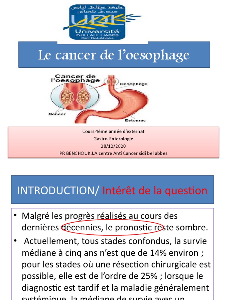 Cancer Oesophage Et Estomac Cancer De L’Oesophage Aujourd’Hui WOQTDI — free download