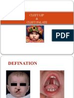 Cleft Lip and Palate