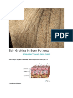 Skin Grafting in Burn Patients