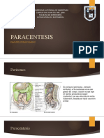 PARACENTESIS