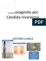 Vulvovaginitis Por Cándida Nivariensis