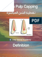 Direct Pulp Capping