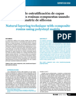 Tecnica de Estratificacion de Capas Natu