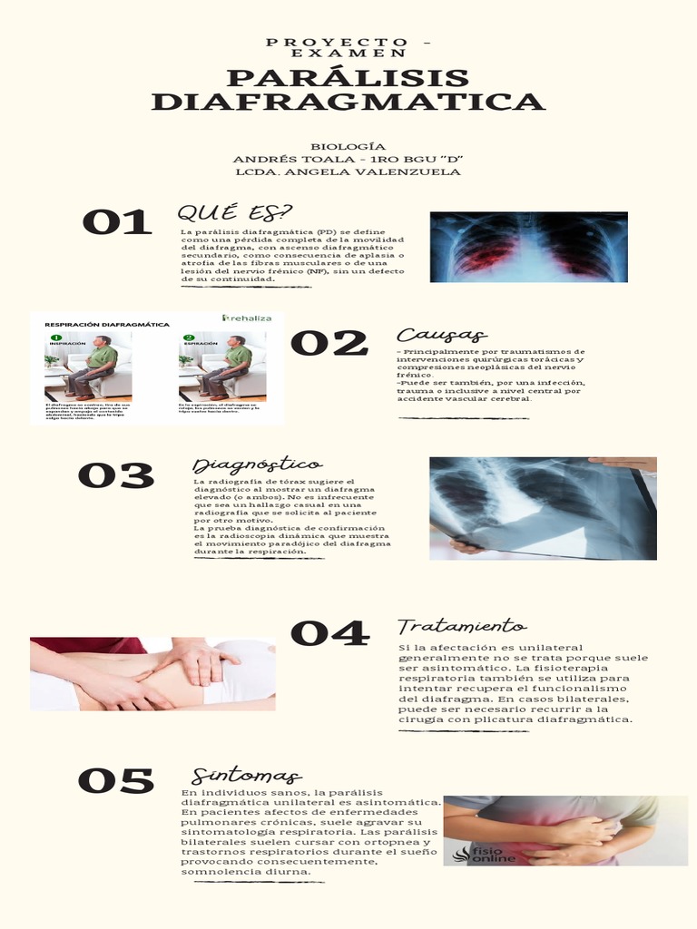 Parálisis Diafragmática PDF Sistema nervioso Ciencias de la Salud