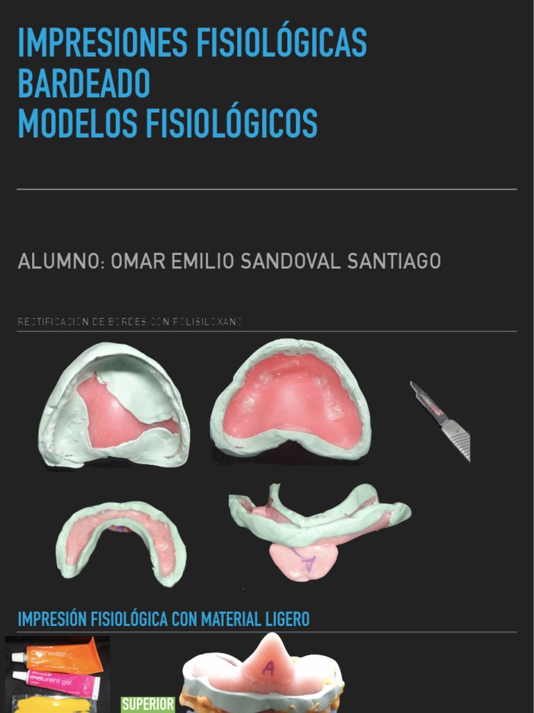 Rectificacion de Bordes | PDF