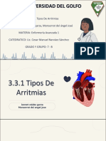 3.3.1 Tipos de Arritmias PDF