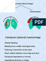 Intracranial Haemorrhage