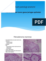 Praktikum S1 Biomedik Tumor Jinak Dan Tumor Ganas Epithelial