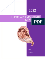 Ruptura Prematura de Membranas