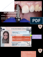 Caso Clinico Implantologia - Karla Quispe
