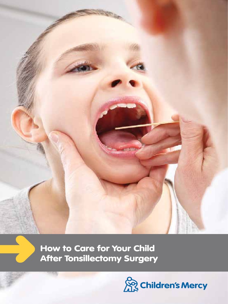 Tonsillectomy After Care English PDF Health Care Medicine