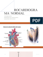 Electrocardiograma Normal2