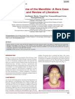 Ewings Sarcoma of The Mandible A Rare Case Report