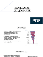 Neoplasias pulmonares: Características y clasificación