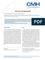 The Management of Portal Vein Thrombosis After Adult Liver Transplantation - A Case Series and Review of The Literature