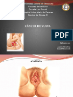 Cancer de Vulva