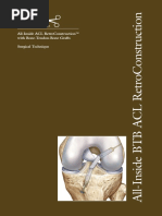 Acl Tightrope Attachable Button System | PDF | Musculoskeletal System ...