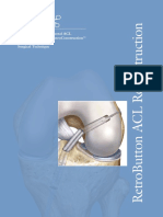 Arthrex RetroButton® For Femoral ACL