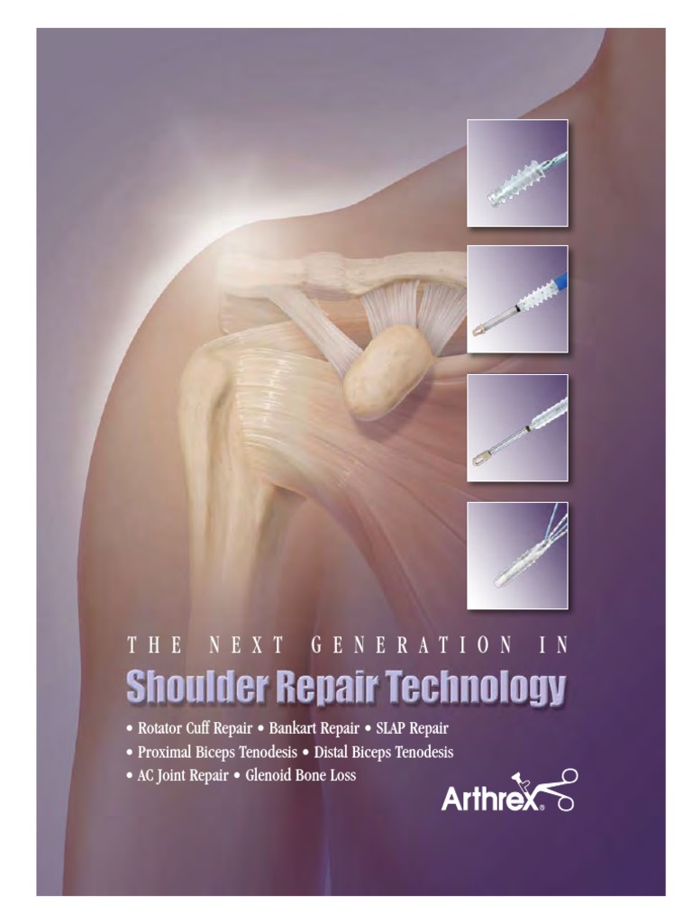 Arthrex Shoulder Repair Tehnology, PDF, Surgical Suture