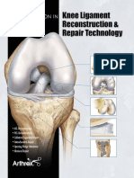Arthrex Knee Ligament Repair