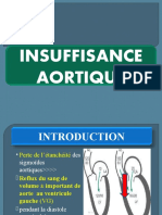 Insuffisance Aortique short