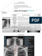 RX de Torax Normal