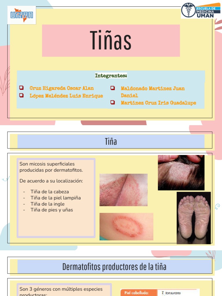 Que Significa Tiña – Hongos Que Causan Tiña – IMCUI