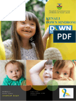 Sindrom Down: Penyebab dan Gejala