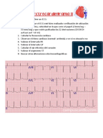 Electrocardiograma II