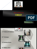 How To Read Chest X-Ray